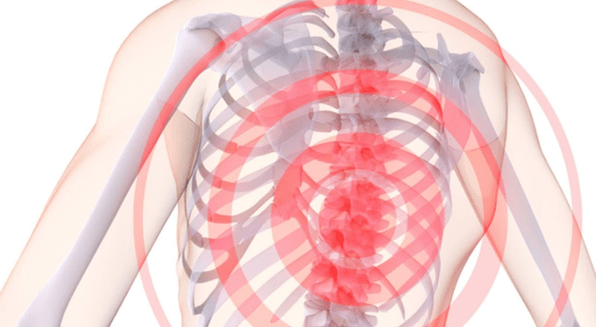 болка в гръбначния стълб с гръдна остеохондроза